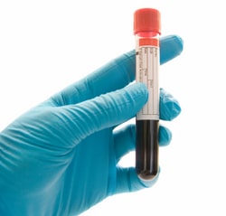 blood test