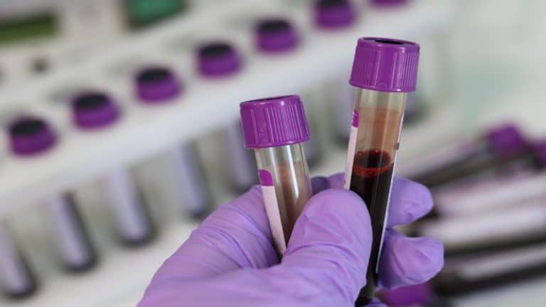 Blood Test