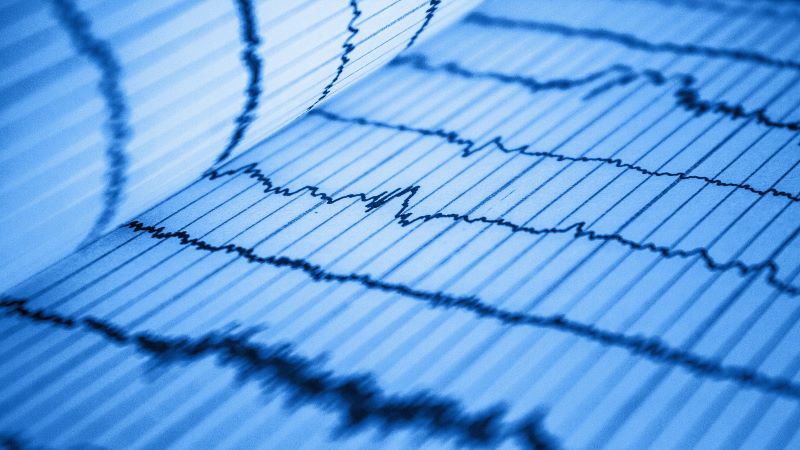 EKG