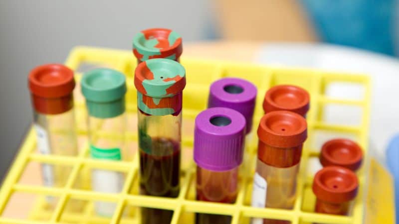 Urine Test