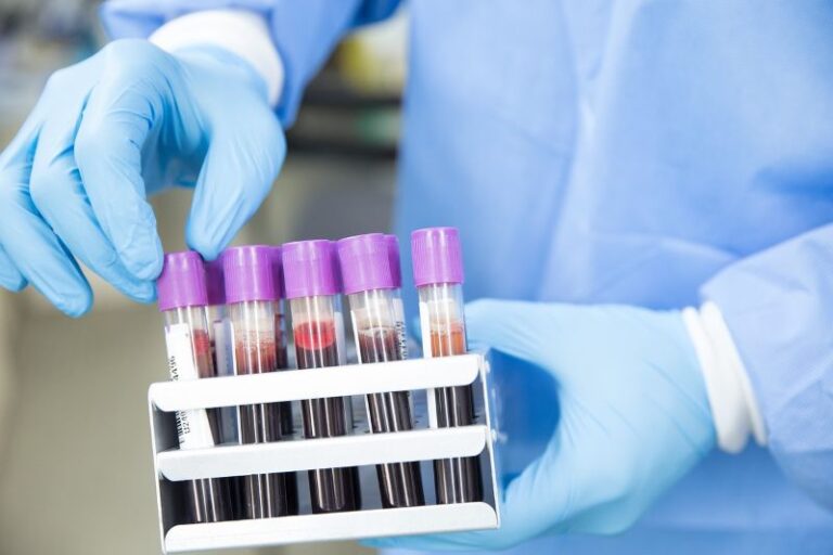 blood test 22